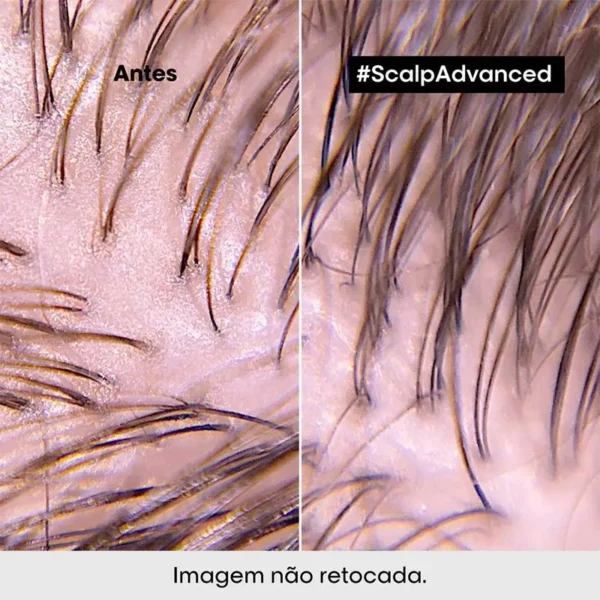 L'Oréal Professionnel Scalp Argila Purificante 500ml - Imagem 4